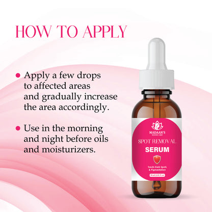 Spot Removal Serum – Dark Spot Corrector, Brightening & Hyperpigmentation Treatment