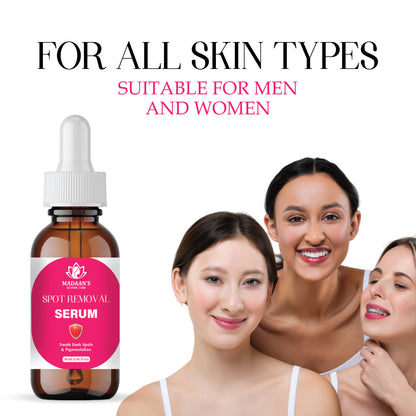 Spot Removal Serum – Dark Spot Corrector, Brightening & Hyperpigmentation Treatment