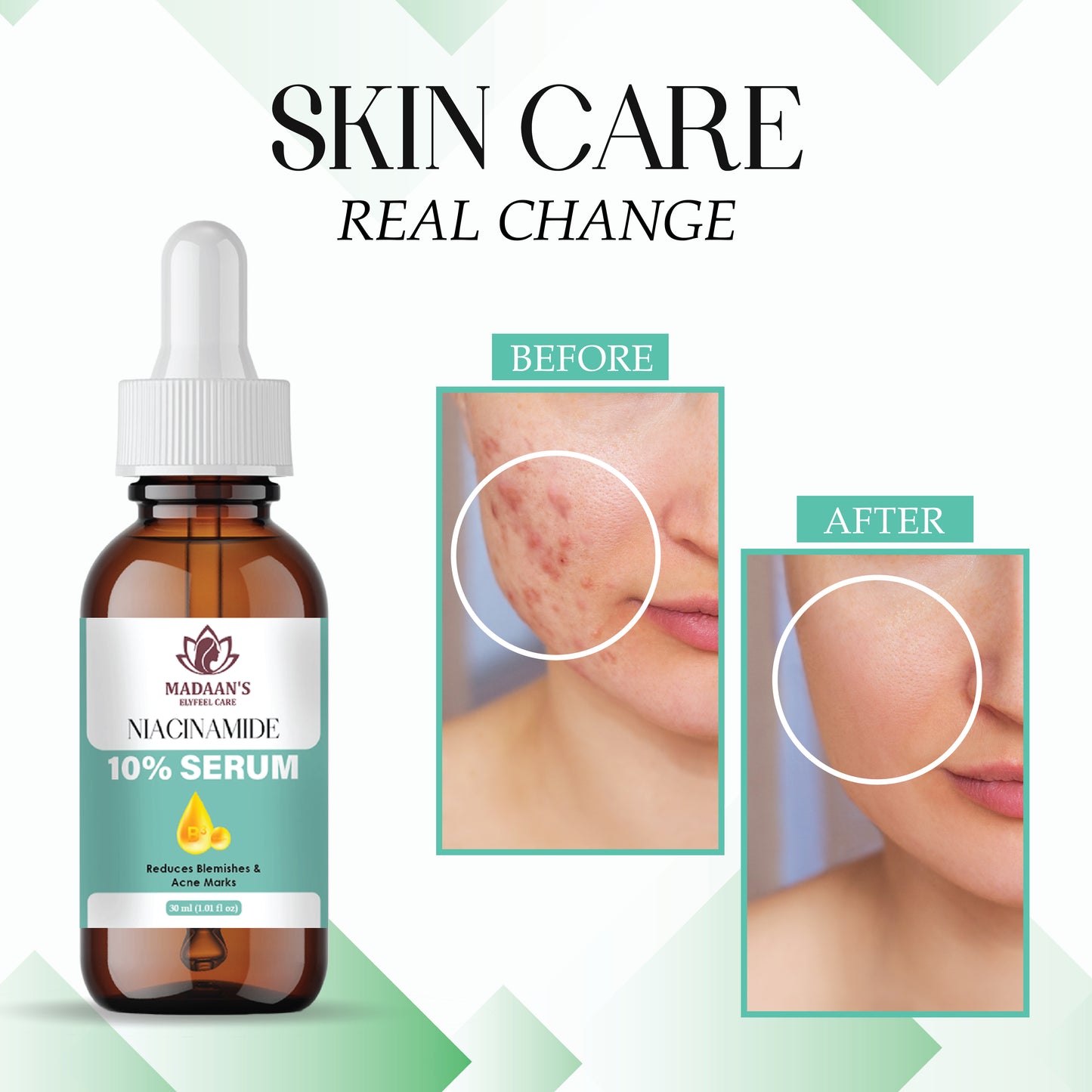 Niacinamide Serum for Face | Acne Marks, Texture Smoothing & Hydration