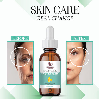 Niacinamide Serum for Face | Acne Marks, Texture Smoothing & Hydration